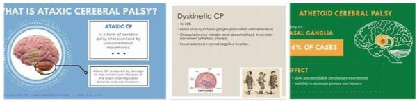 Dyskinetic Voice Disorder